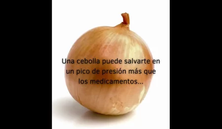 Cebolla